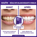 Bandes Blanchissantes Violettes GlowSmile V34 — 42 Bandes